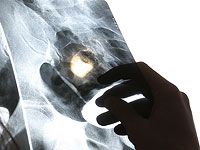 Стекло, напечатанное на 3D-принтере, может стать заменителем костей