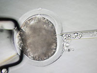 Ученые создали яйцеклетки с использованием ДНК из человеческой кожи