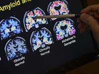 Израильское исследование: искусственный интеллект сокращает ожидание расшифровки CT