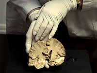 Ученые выращивают миниатюрные человеческие мозги для питания компьютеров