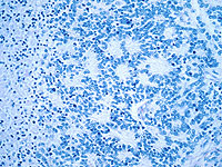 Пищевые жирные кислоты могут 