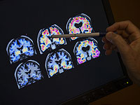 Почему мозги разных людей видят мир одинаково: открытие израильских нейробиологов