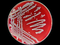 Антарктический микроб вырабатывает вещество с пищевым, косметическим и лечебным потенциалом
