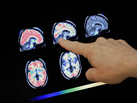 Исследование показало, что мозг у мужчин уменьшается быстрее, чем у женщин