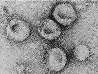 Ученые создали свиней, устойчивых к классической чуме Pestis suum