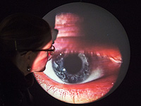 Сканирование глаза может выявить риски для сердца