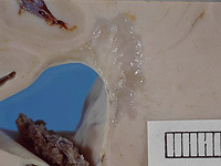 Клетки, покрытые противовоспалительными 