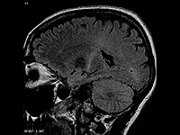 Израильские ученые нашли механизм, запускающий 