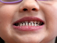 У детей, чьи мамы находятся в состоянии стресса, зубы прорезаются раньше