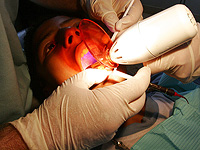 Лечение корневых каналов зубов может значительно снизить уровень сахара в крови