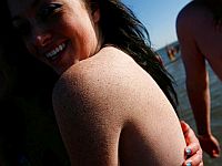 Прорывное лечение диабета может доставлять инсулин через крем для кожи