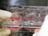 Ученые создали искусственный хрящ с использованием стволовых клеток костного мозга