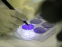 Разработан новый метод омоложения старых и поврежденных клеток человека