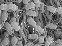 Широко используемые пестициды могут снизить количество сперматозоидов