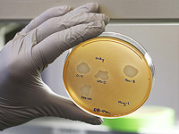 Микробы в воздухе самолетов и больниц безвредны. Новое исследование Микробы в воздухе самолетов и больниц безвредны. Новое исследование