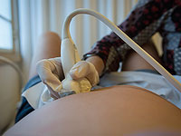 В Перу зарегистрирован первый случай рождения ребенка после внематочной беременности в печени