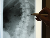 С возрастом иммунные клетки защищают спинной мозг