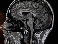Скончался самый молодой человек с диагнозом деменция