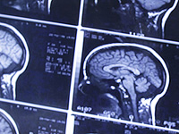 Ученые представили мозговой микрочип, который передает мысли в режиме реального времени