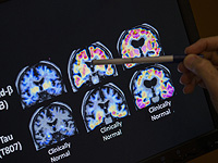 Ученые предложили метод смягчения тяжелых воспоминаний на фоне резкого роста ПТСР в Израиле