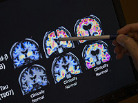 Ученые использовали стимуляцию мозга, чтобы сделать людей более щедрыми