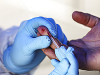 Израильский стартап проводит диагностику рака по капле крови за 30 секунд