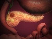 Израильские ученые показали, как рак поджелудочной железы прячется от иммунной системы Израильские ученые показали, как рак поджелудочной железы прячется от иммунной системы