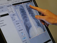 Воздействие микробов может приучить легкие к сопротивлению астме