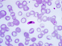 Израильские ученые показали, как малярийный плазмодий взламывает иммунитет