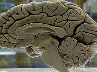 Возможно, вся система удовольствия в мозге всего лишь следствие настройки энергического баланса Возможно, вся система удовольствия в мозге всего лишь следствие настройки энергического баланса