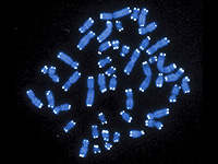 Ген, отвечающий за жизнь в горах, может помочь лечить рассеянный склероз