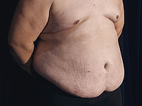 Снижение жира в области живота помогает сохранить когнитивные способности. Израильское исследование