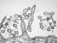 Минздрав Израиля: случаев заражения хантавирусом в стране за последние дни не зафиксировано