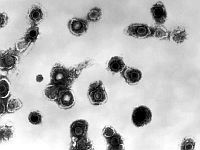 Минздрав предупреждает: в самолете, прибывшем из Азербайджана, был больной ветрянкой