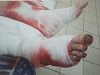 Задержан преступник, который натравил на старика собаку и обокрал его