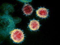 Израильские ученые моделировали в лаборатории эволюцию вируса при пандемии COVID-19