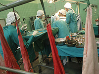 Впервые человеку пересадили несколько органов свиньи