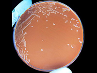 Непривитый младенец в тяжелом состоянии из-за редкого осложнения простуды