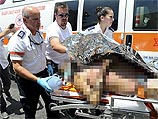 Эвакуация пострадавшего после акта самосожжения 22 июля в Йехуде