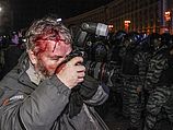 Глеб Горанич, фотограф Reuters, пострадавший при разгоне демонстрации на Площади Независимости. Киев, 30.11.2013