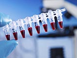 В США изобрели домашнюю мини-лабораторию для контроля за состоянием здоровья