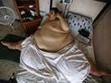Умер самый толстый человек в мире, который весил 600 кг