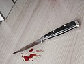 Житель Бат-Яма ударил ножом жену. Женщина в тяжелом состоянии