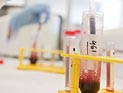 Медики США: жир из костного мозга оздоравливает организм