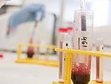 Медики США: жир из костного мозга оздоравливает организм