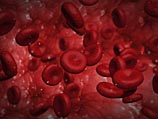 Американские ученые нашли новый способ лечения лейкемии   
