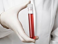 Острый дефицит донорской крови: МАДА просит израильтян сдавать кровь