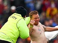 Матч Кубка мира по крикету был прерван из-за голого болельщика