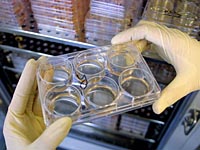 В США обнаружен ранее неизвестный смертельный вирус