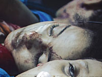 Германский суд постановил убрать антиизраильскую выставку в Кельне